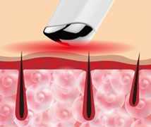 NanoEye EyeMagic red LED mode