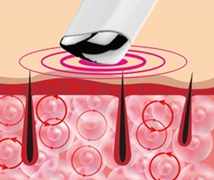 NanoEye EyeMagic sonic massage