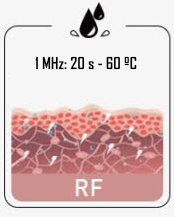 NanoSkin RF radio frequency mode